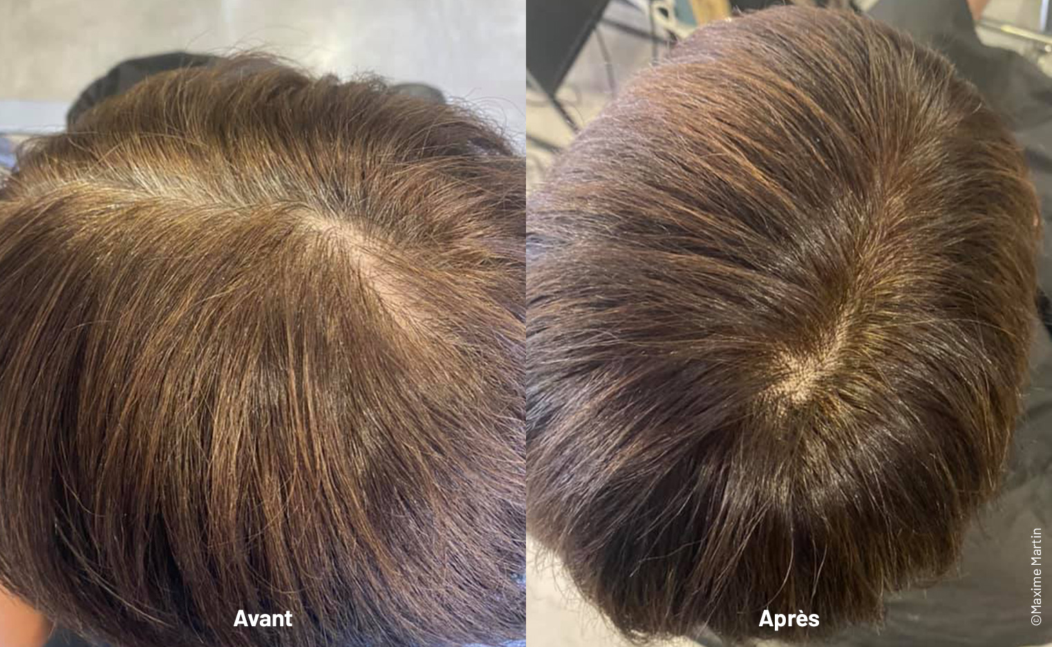 Avant apres Coloration naturelle 1.0 Brun